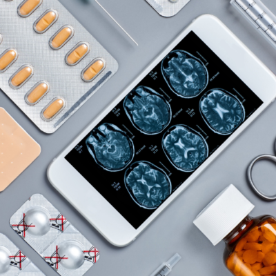 Phone with MRI report and various medical paraphernalia